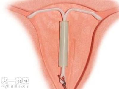 避孕不当会引起月经不调吗 揭秘导致月经不调的避孕方式